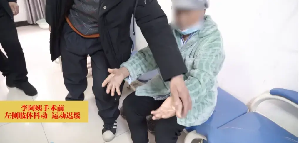 After more than 7 years of treatment for Parkinson's syndrome, trembling and stiffness are significantly reduced after robotic surgery