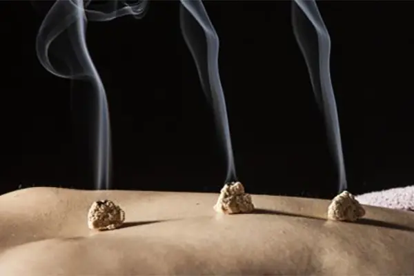 Chinese medicine Rehabilitation